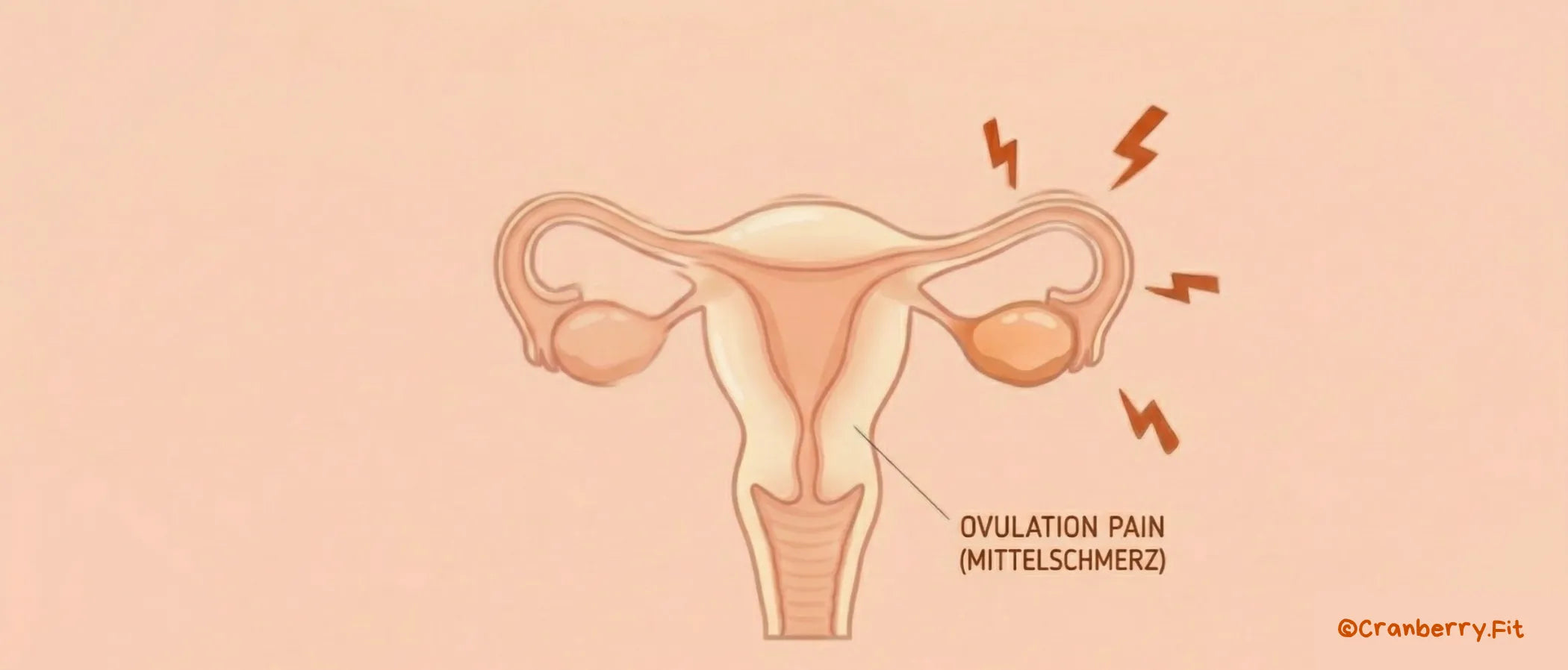 Visual representation of the uterus, highlighting areas related to ovulation pain.