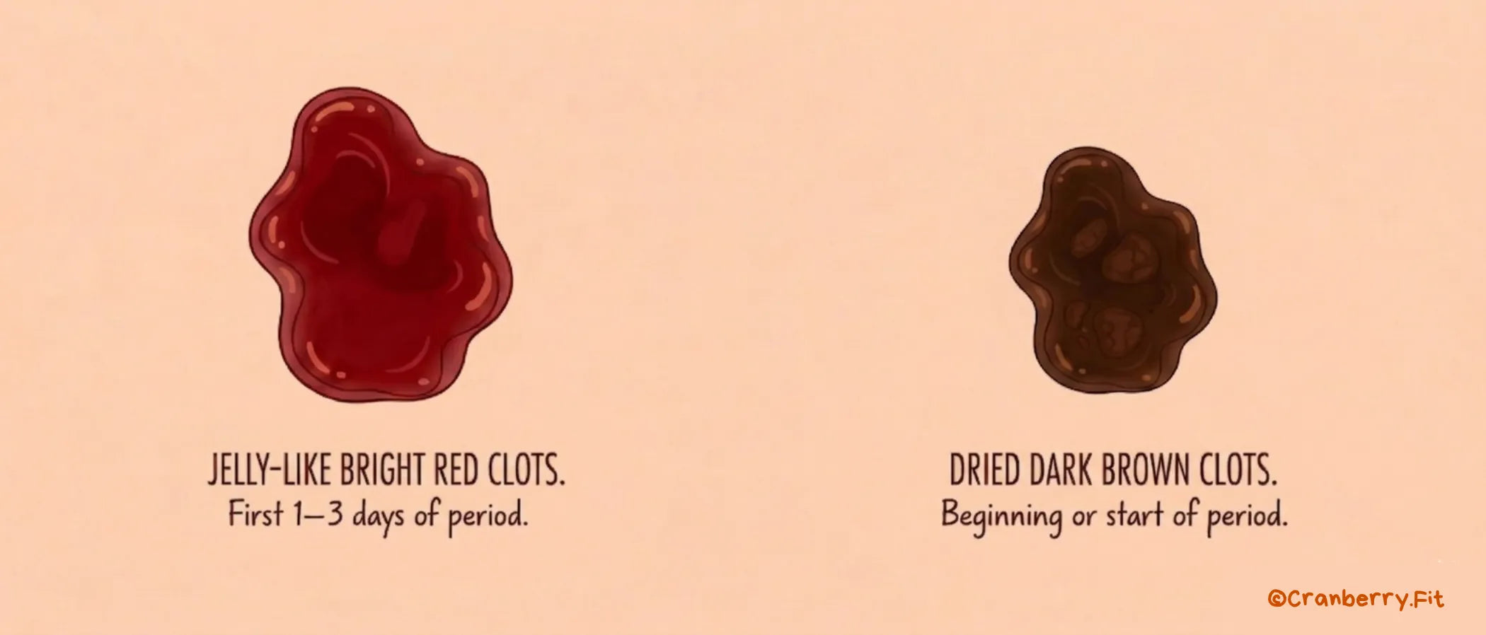 Illustrated infographic depicting two types of period blood clots, including jelly-like bright red clots and dried dark brown clots. 