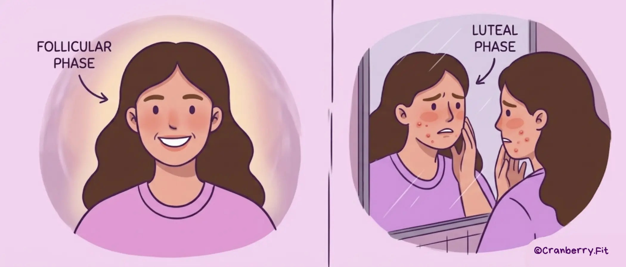 Illustration of a woman looking in the mirror, showcasing radiant skin in the follicular phase and breakouts in the luteal phase.